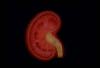 Medical Animation