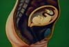 Medical Animation