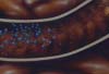 Medical Animation